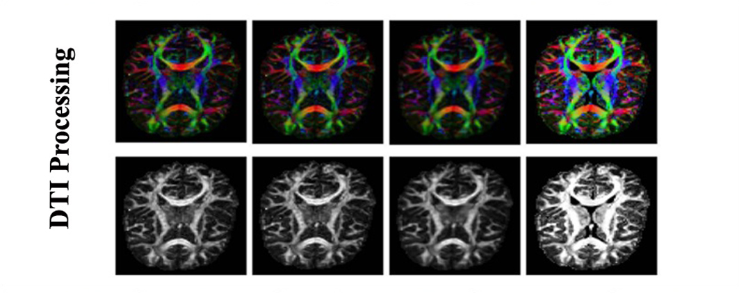 DTI Processing